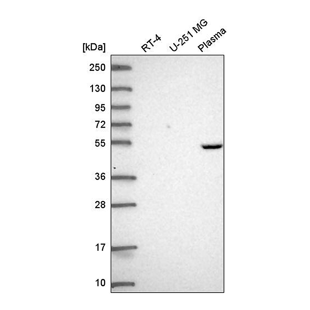 Atlas Antibodies Anti-PDSS1 Antibody