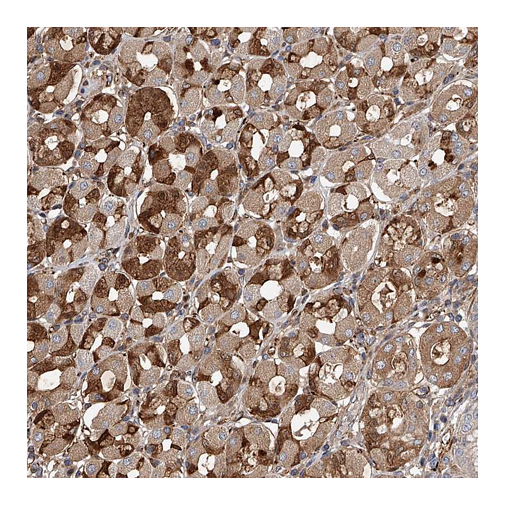 Atlas Antibodies Anti-PDSS2 Antibody