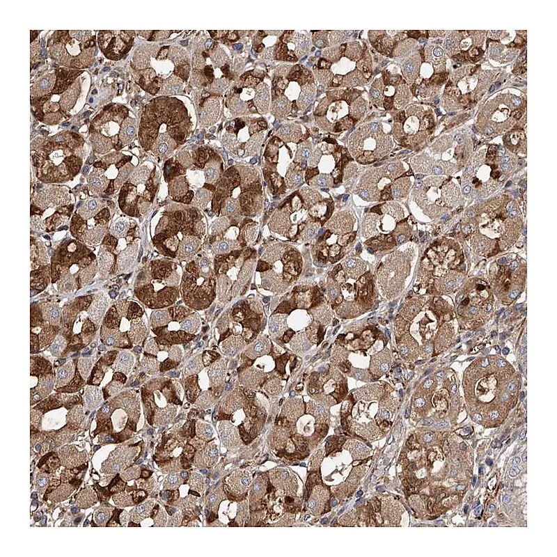 Atlas Antibodies Anti-PDSS2 Antibody