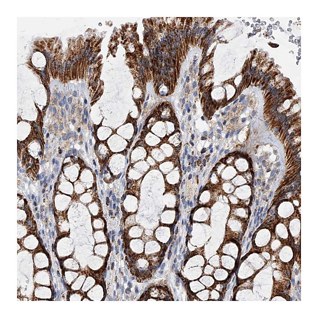 Atlas Antibodies Anti-PDSS2 Antibody