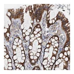 Atlas Antibodies Anti-PDSS2 Antibody