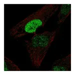 Atlas Antibodies Anti-PDX1 Antibody
