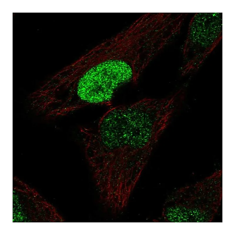 Atlas Antibodies Anti-PDX1 Antibody