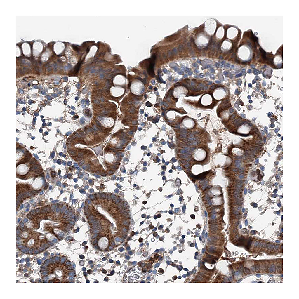Atlas Antibodies Anti-PDSS1 Antibody