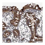 Atlas Antibodies Anti-PDSS1 Antibody