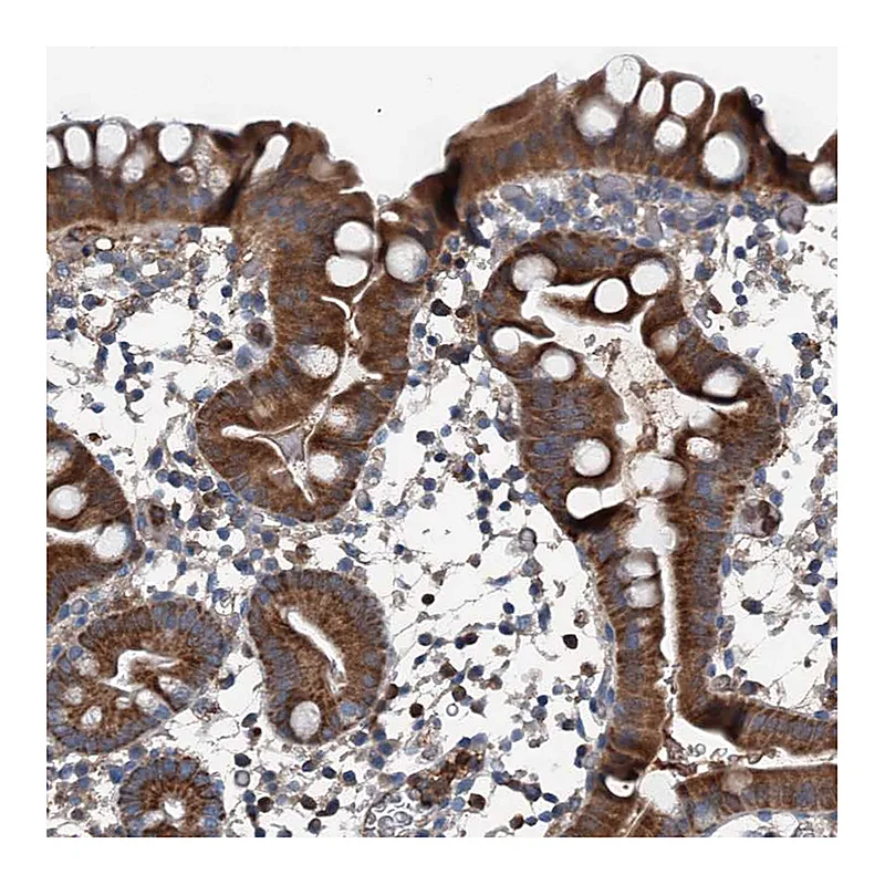 Atlas Antibodies Anti-PDSS1 Antibody