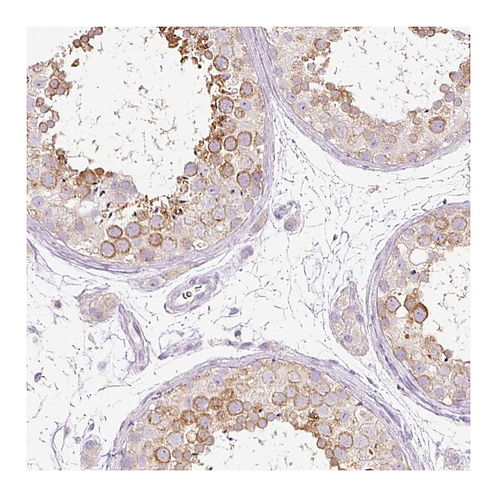 Atlas Antibodies Anti-PDXDC1 Antibody