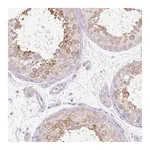Atlas Antibodies Anti-PDXDC1 Antibody