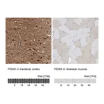 Atlas Antibodies Anti-PDXK Antibody