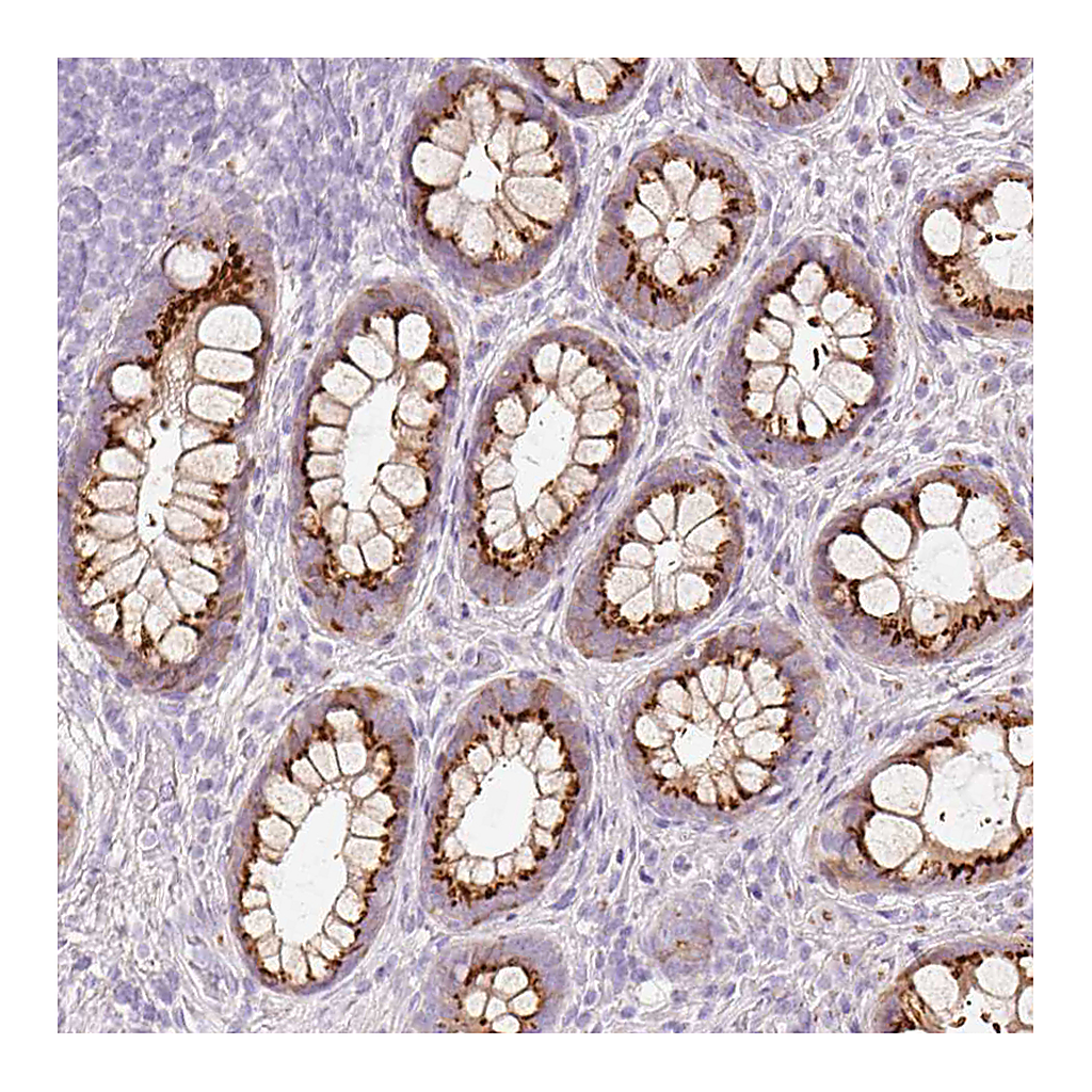 Atlas Antibodies Anti-PDXDC1 Antibody