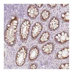 Atlas Antibodies Anti-PDXDC1 Antibody