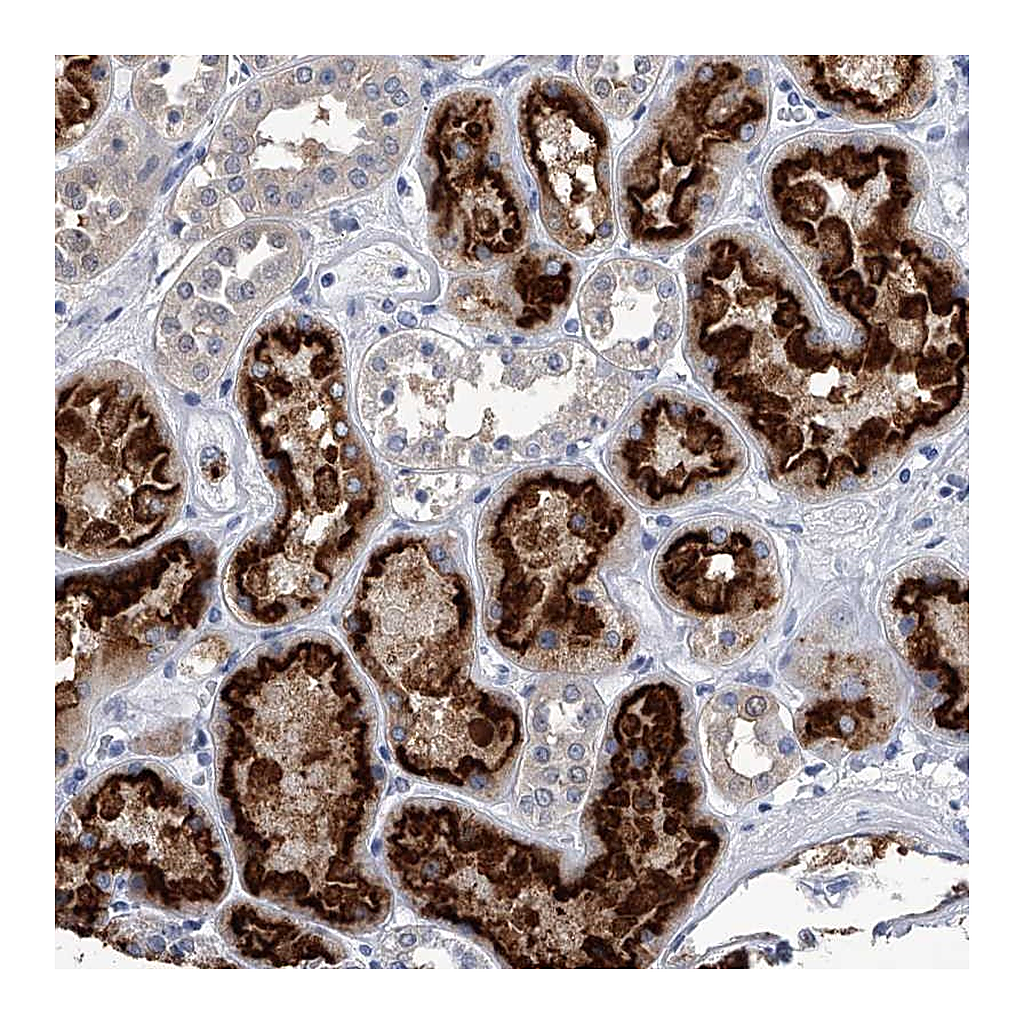 Atlas Antibodies Anti-PDXK Antibody