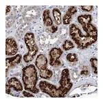 Atlas Antibodies Anti-PDXK Antibody