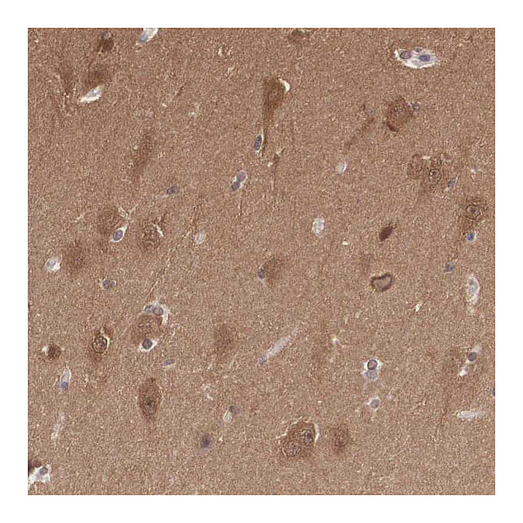 Atlas Antibodies Anti-PDXP Antibody