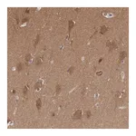Atlas Antibodies Anti-PDXP Antibody
