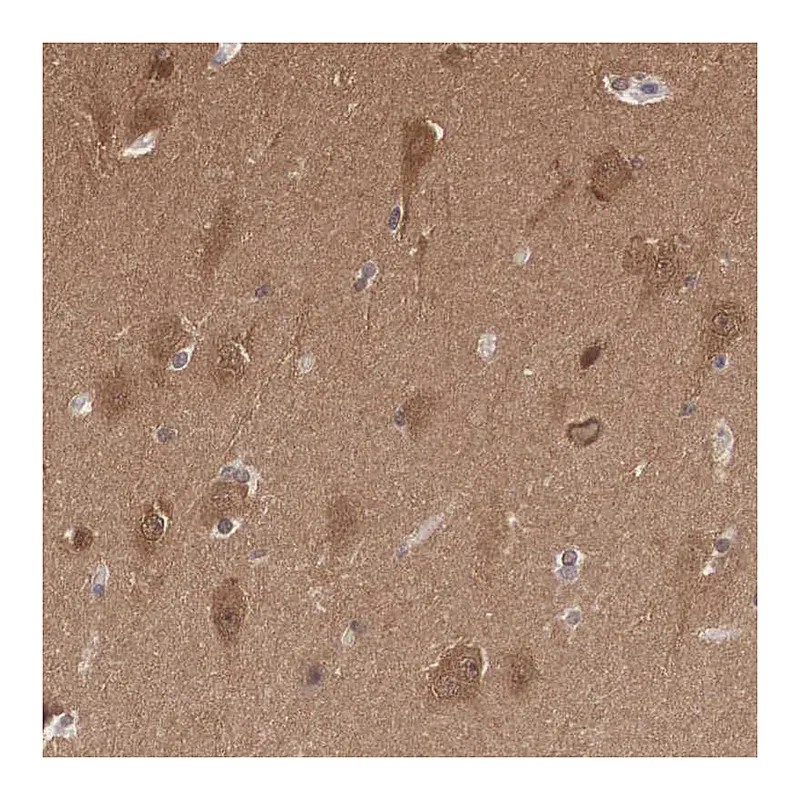 Atlas Antibodies Anti-PDXP Antibody