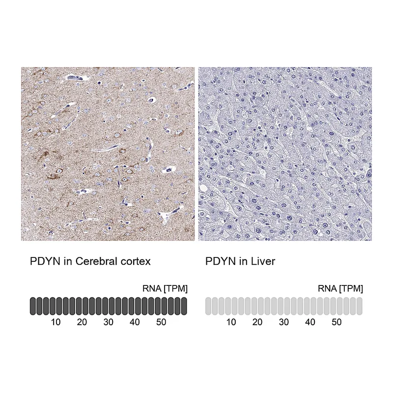Atlas Antibodies Anti-PDYN Antibody