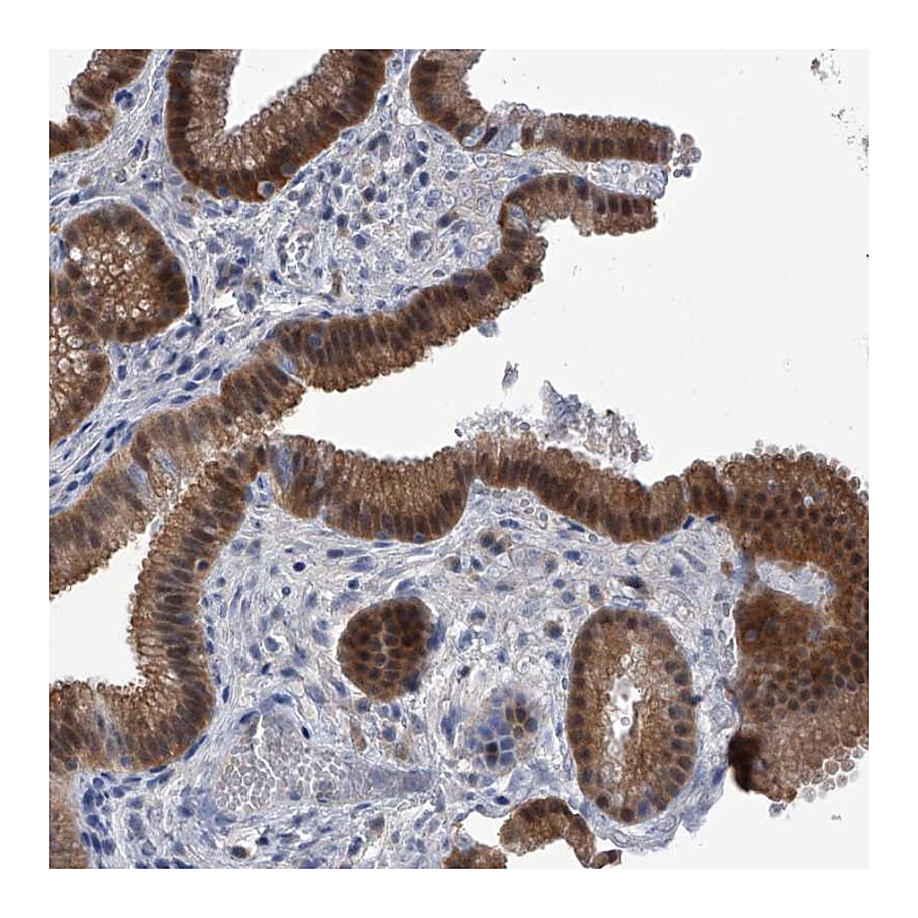 Atlas Antibodies Anti-PDXK Antibody