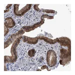 Atlas Antibodies Anti-PDXK Antibody