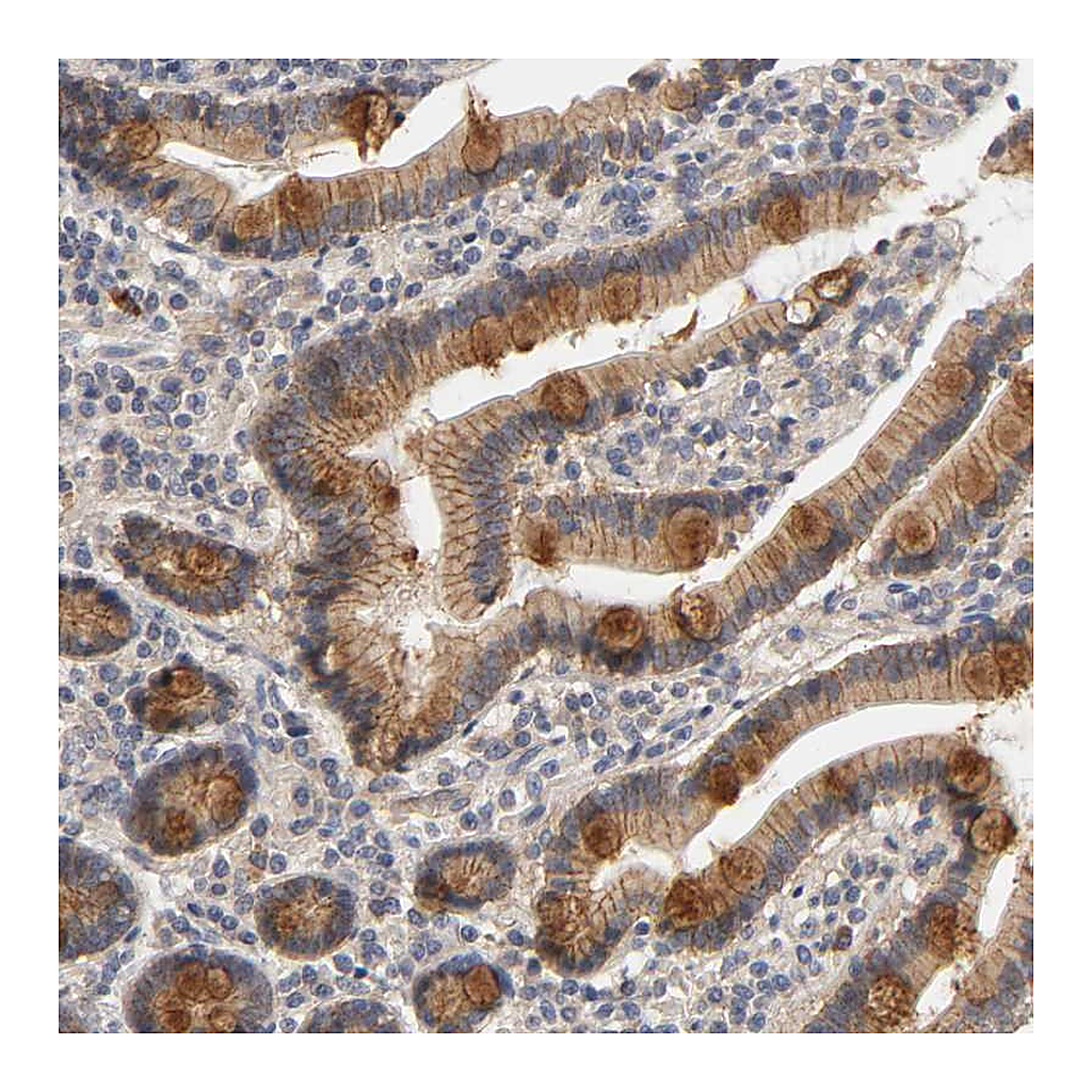 Atlas Antibodies Anti-PDZD11 Antibody