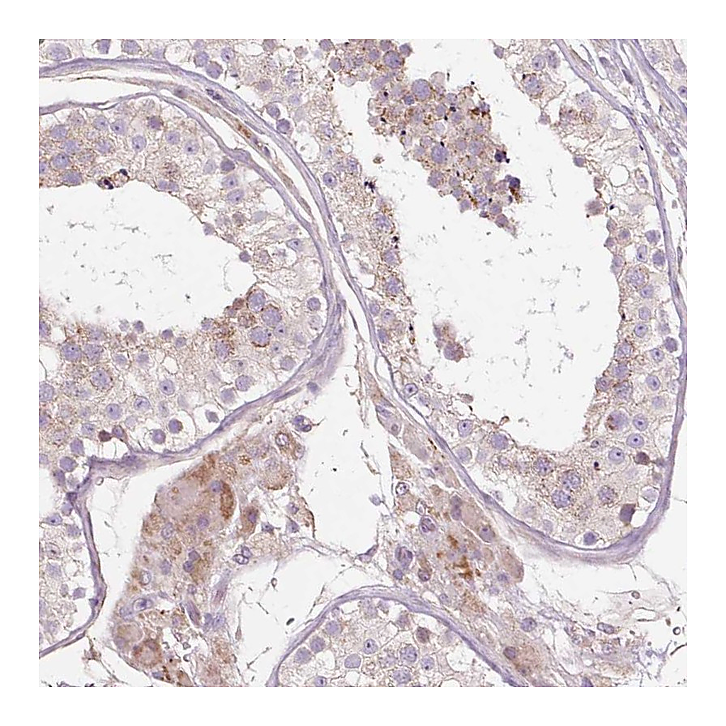Atlas Antibodies Anti-PDZD2 Antibody