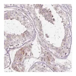 Atlas Antibodies Anti-PDZD2 Antibody