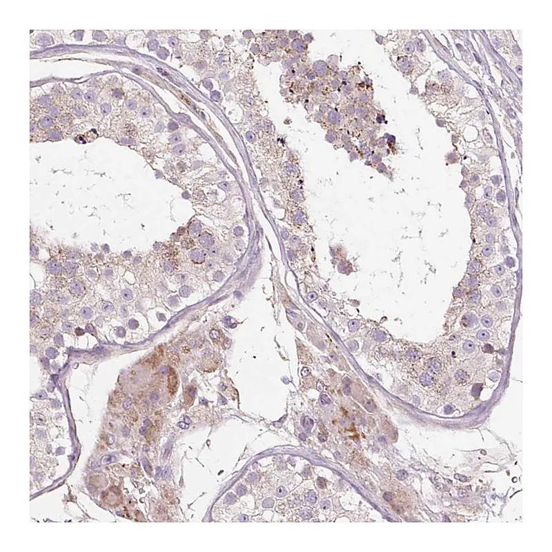 Atlas Antibodies Anti-PDZD2 Antibody