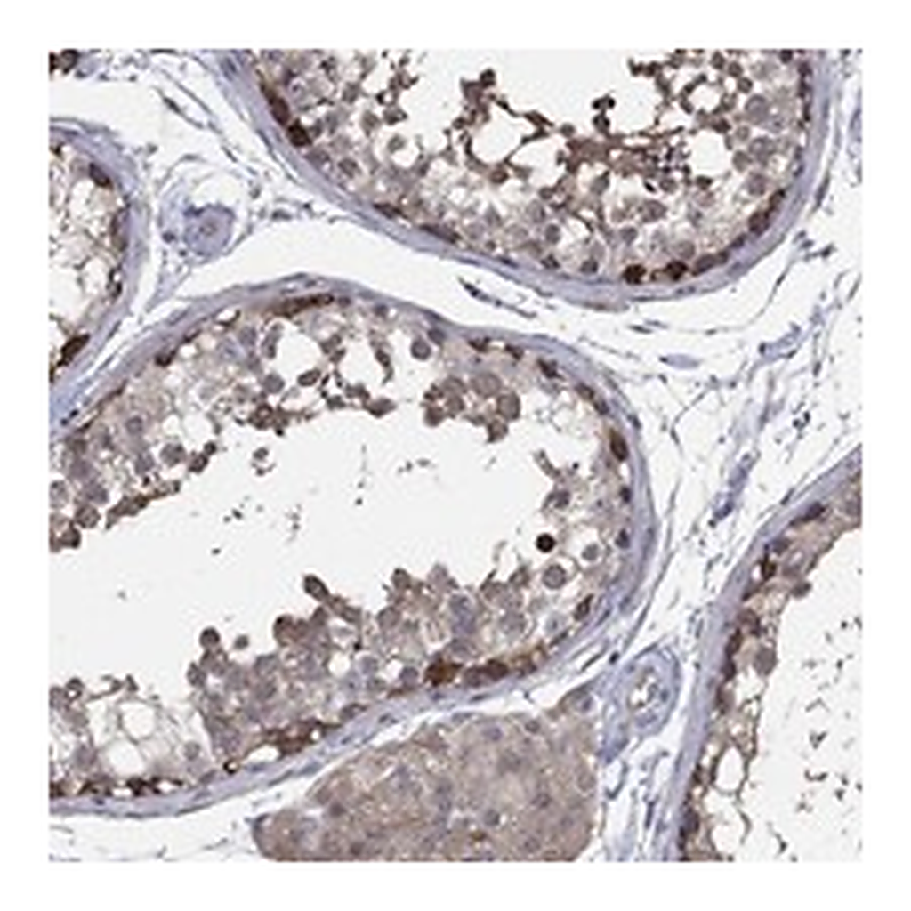 Atlas Antibodies Anti-PDZD2 Antibody