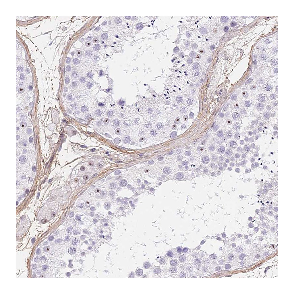 Atlas Antibodies Anti-PDZD2 Antibody