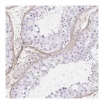 Atlas Antibodies Anti-PDZD2 Antibody