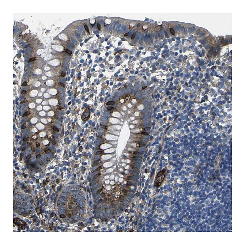 Atlas Antibodies Anti-PDZD8 Antibody