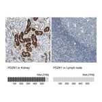 Atlas Antibodies Anti-PDZK1 Antibody