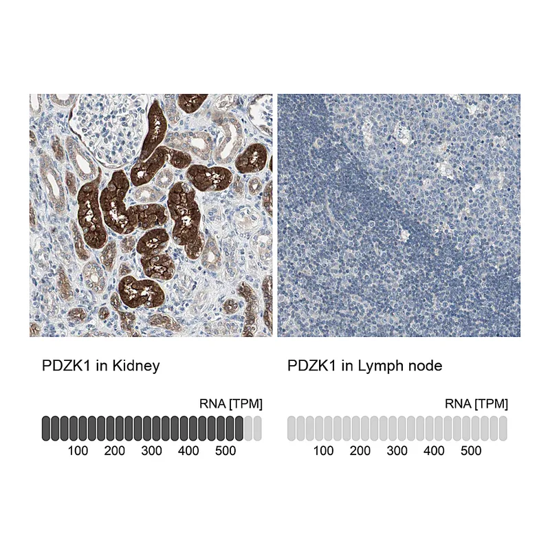 Atlas Antibodies Anti-PDZK1 Antibody