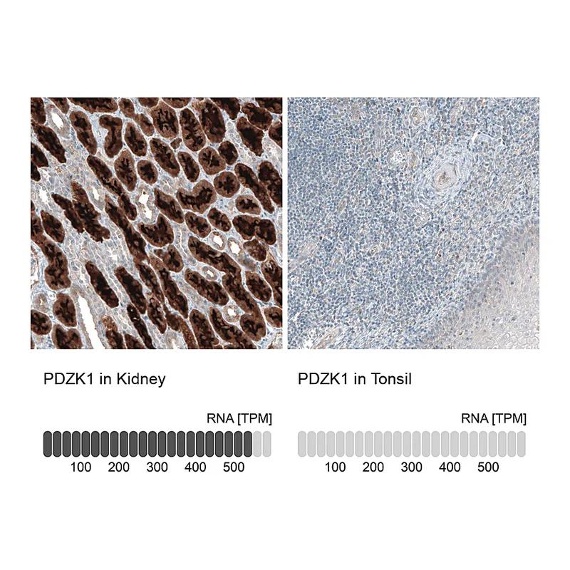 Atlas Antibodies Anti-PDZK1 Antibody