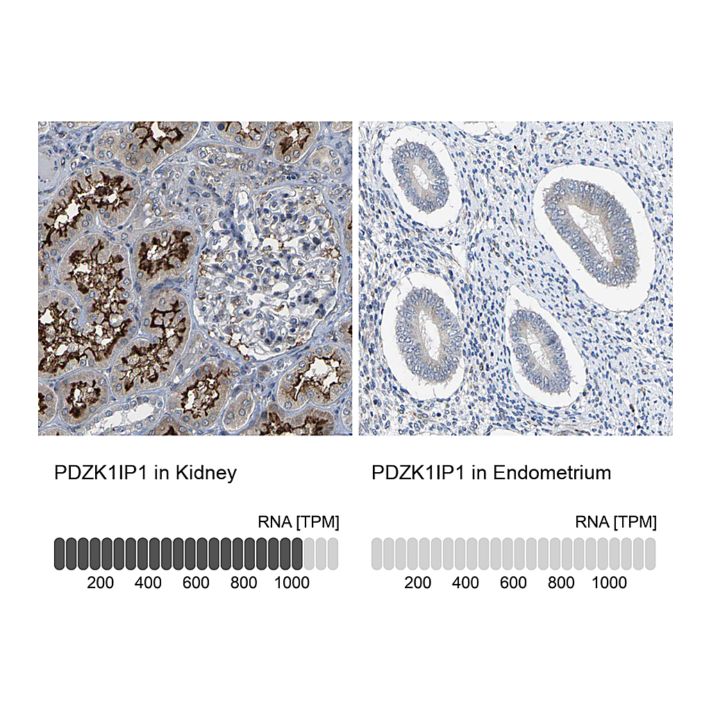 Atlas Antibodies Anti-PDZK1IP1 Antibody