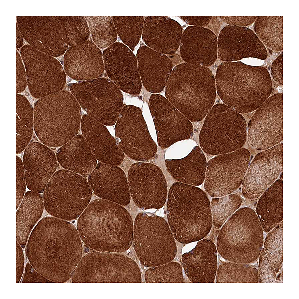 Atlas Antibodies Anti-PDZRN3 Antibody