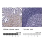 Atlas Antibodies Anti-PDZRN4 Antibody