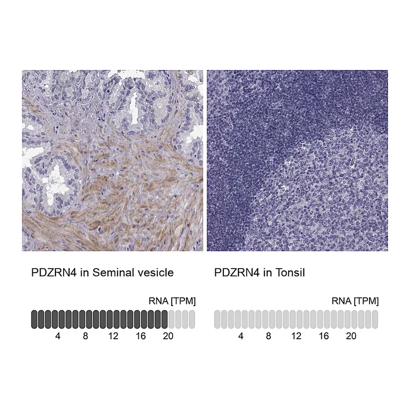 Atlas Antibodies Anti-PDZRN4 Antibody