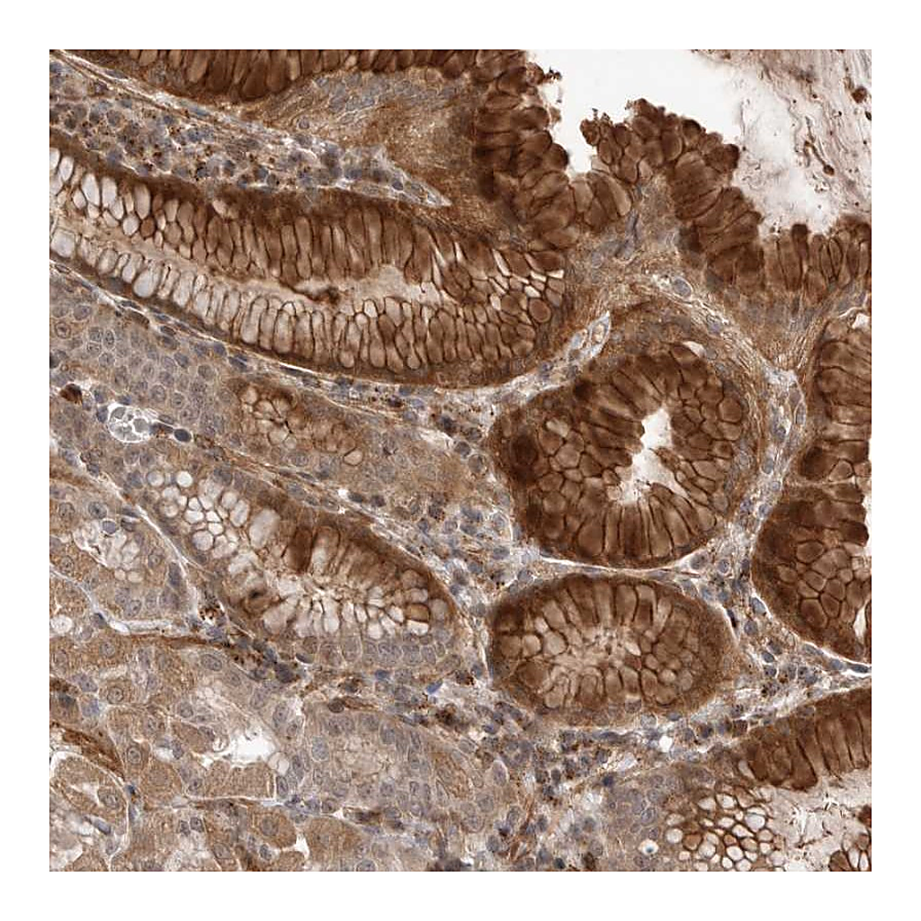 Atlas Antibodies Anti-PEAK1 Antibody