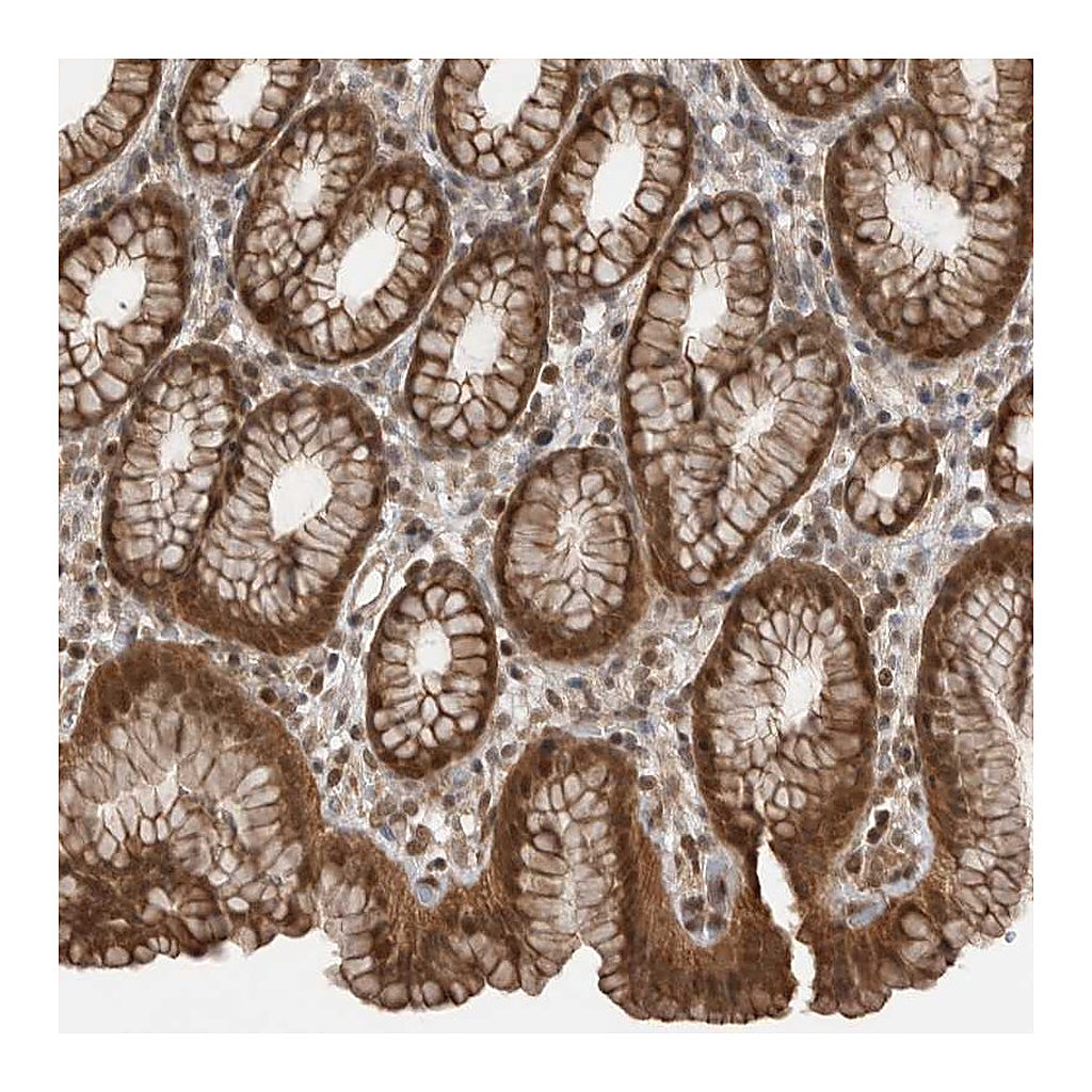 Atlas Antibodies Anti-PEAK1 Antibody