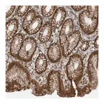 Atlas Antibodies Anti-PEAK1 Antibody