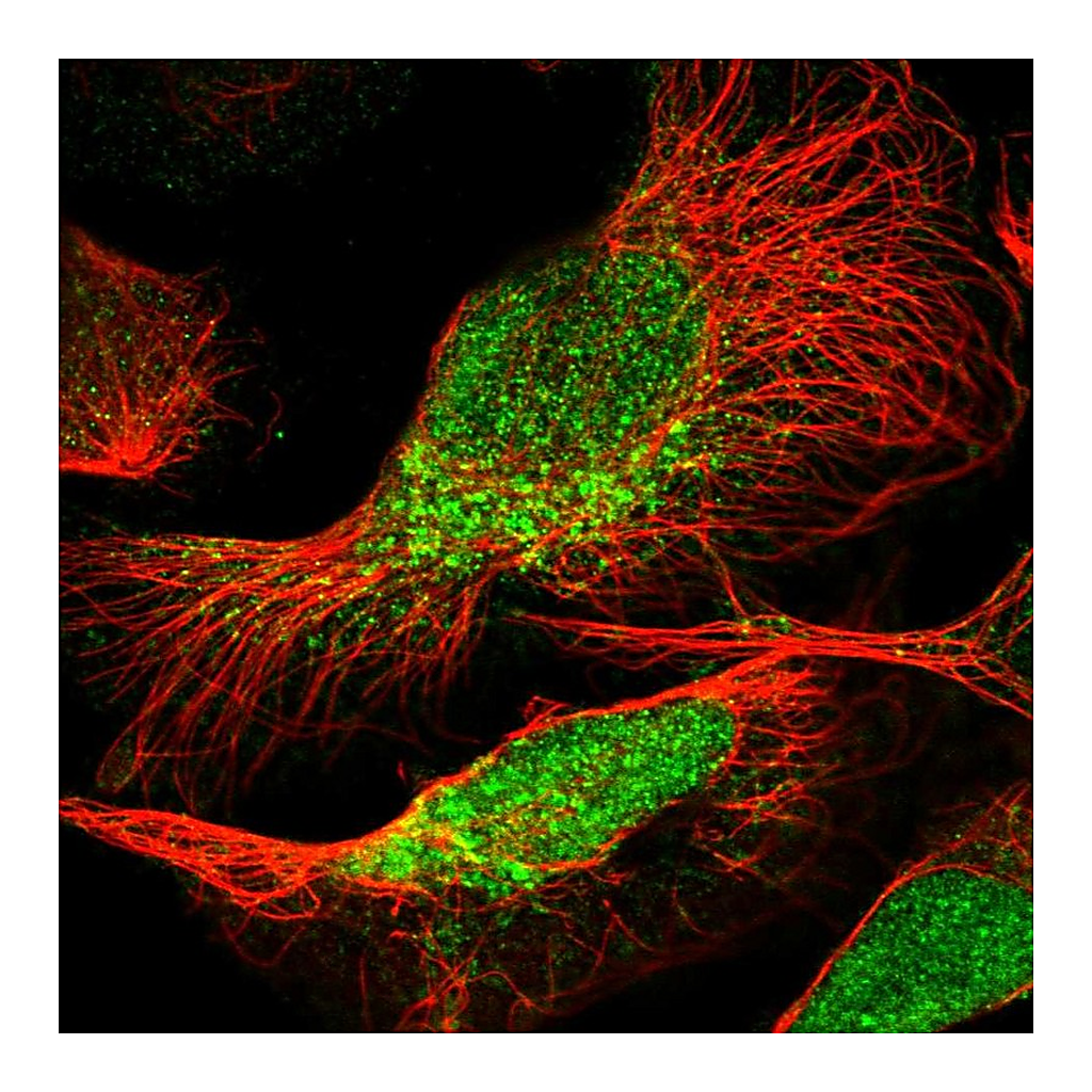 Atlas Antibodies Anti-PEA15 Antibody