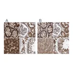 Atlas Antibodies Anti-PECR Antibody