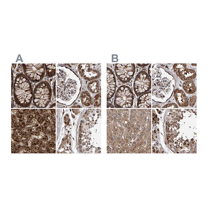 Atlas Antibodies Anti-PECR Antibody