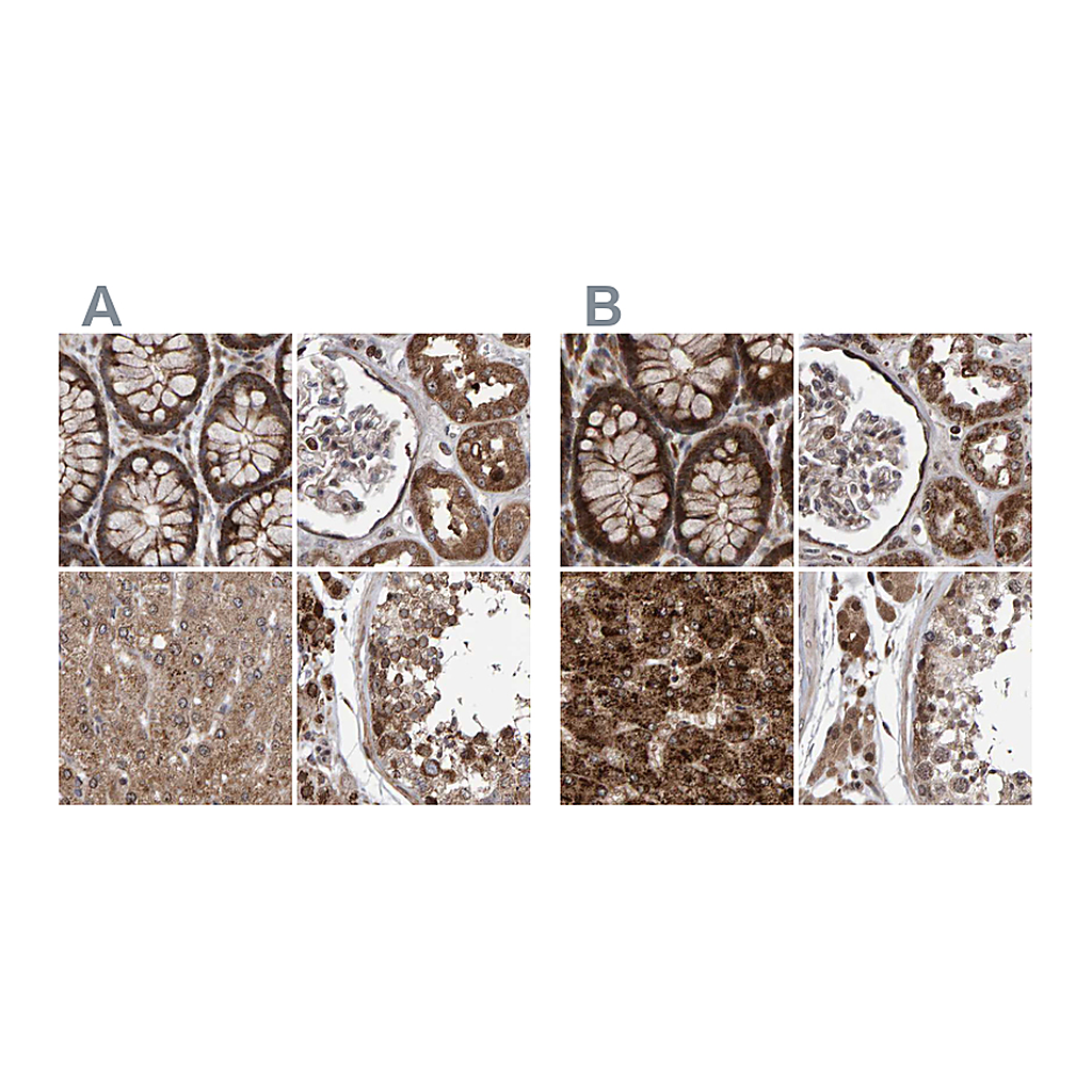 Atlas Antibodies Anti-PECR Antibody