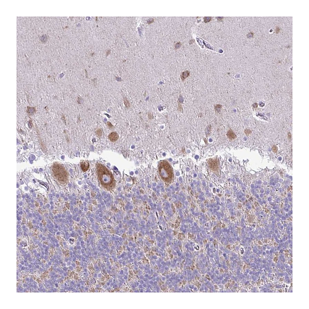 Atlas Antibodies Anti-PELI3 Antibody