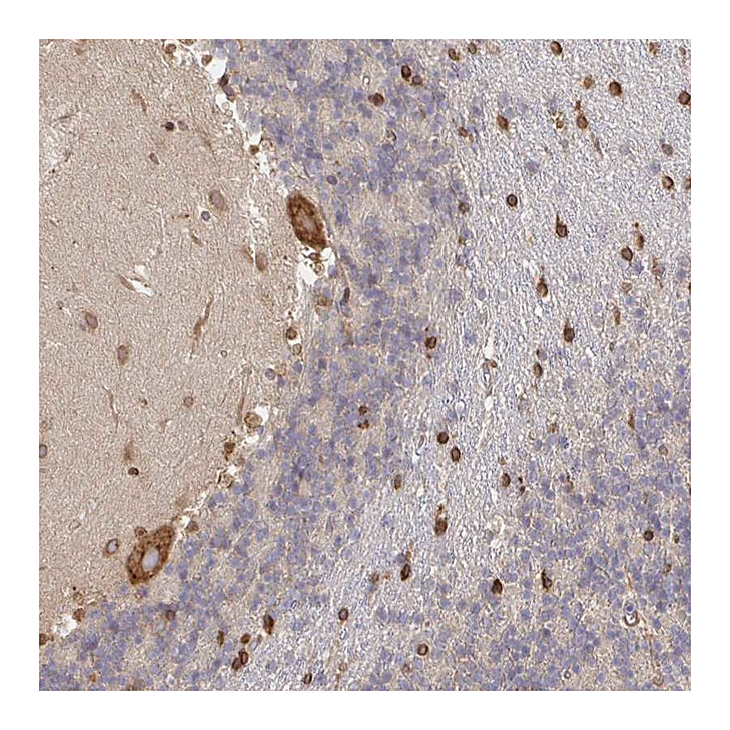 Atlas Antibodies Anti-PELI3 Antibody