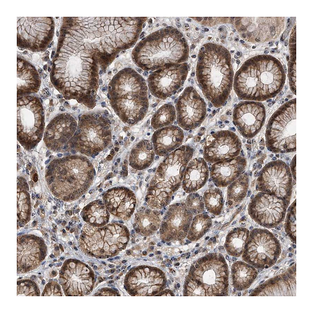 Atlas Antibodies Anti-PELO Antibody
