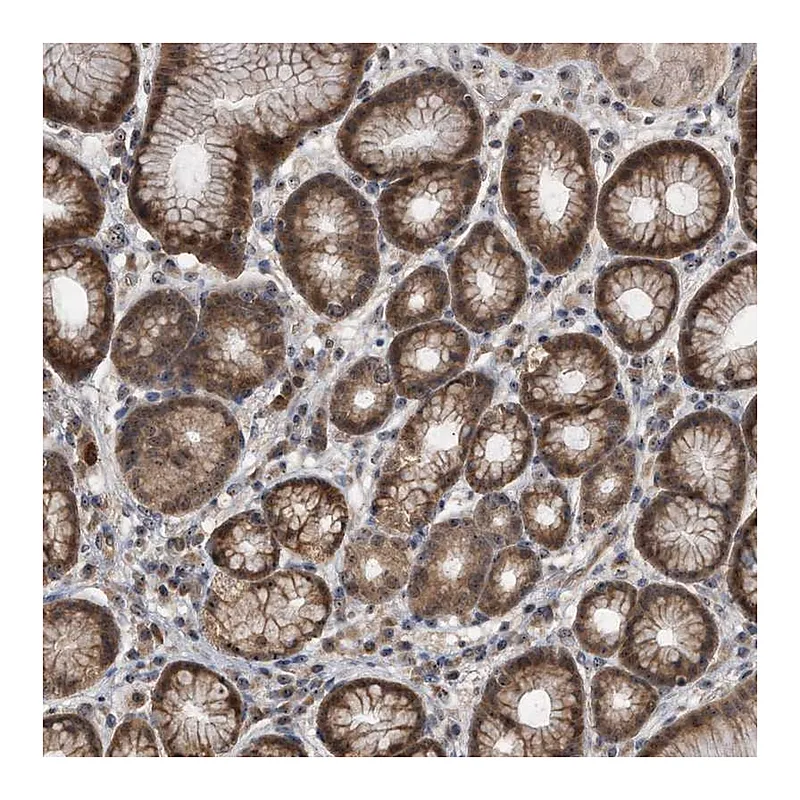 Atlas Antibodies Anti-PELO Antibody