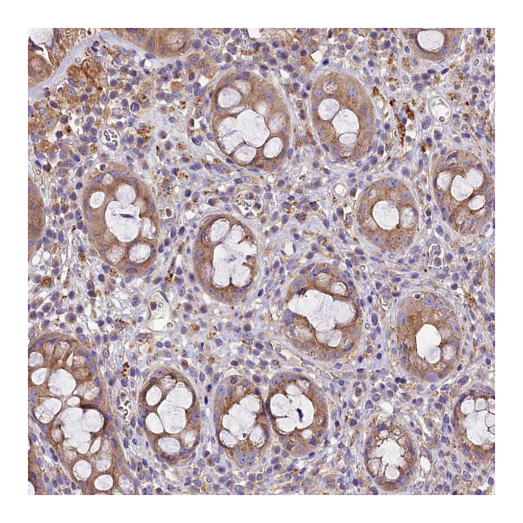 Atlas Antibodies Anti-PEMT Antibody